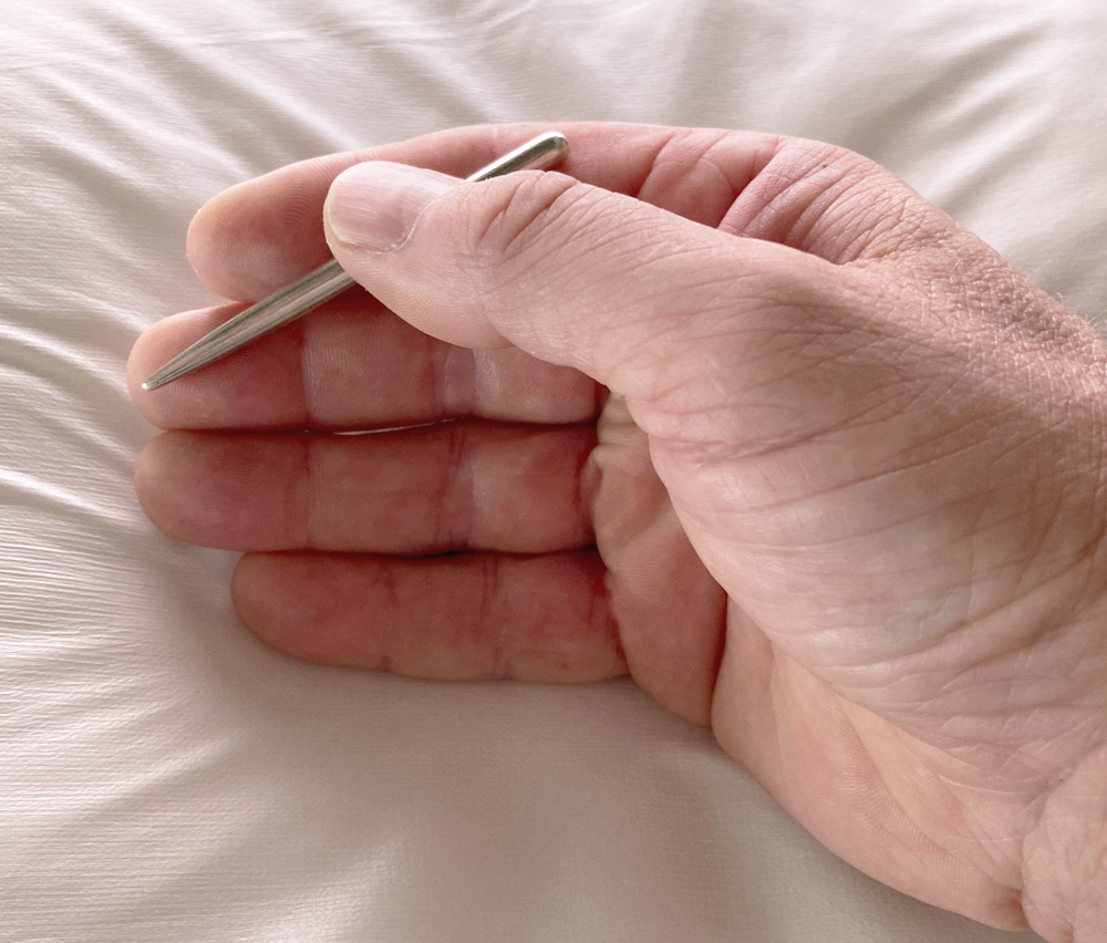Acupuncture Photo